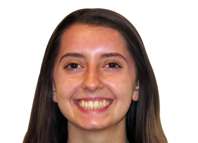 Patient smile after orthodontic treatment
