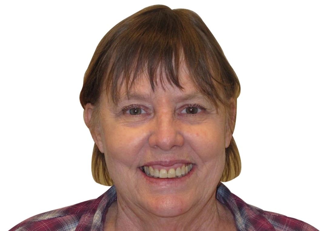 Patient smile after orthodontic treatment