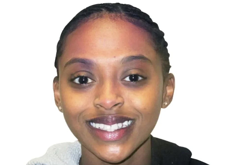 Patient smile before orthodontic treatment